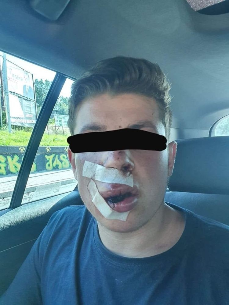 Pobili studenta za to, że jest w Ukrainy. Policja szuka sprawców, FB / OMZRiK